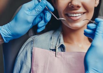 مراحل و موارد کاربرد آنلی دندان چیست؟ | بهترین دندانپزشک زیبایی اصفهان