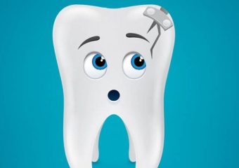 بررسی انواع شکستگی ریشه دندان | بهترین دندانپزشک اصفهان