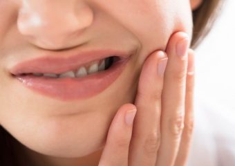 فلیرآپ در درمان ریشه چیست؟ | بهترین دندانپزشک اصفهان