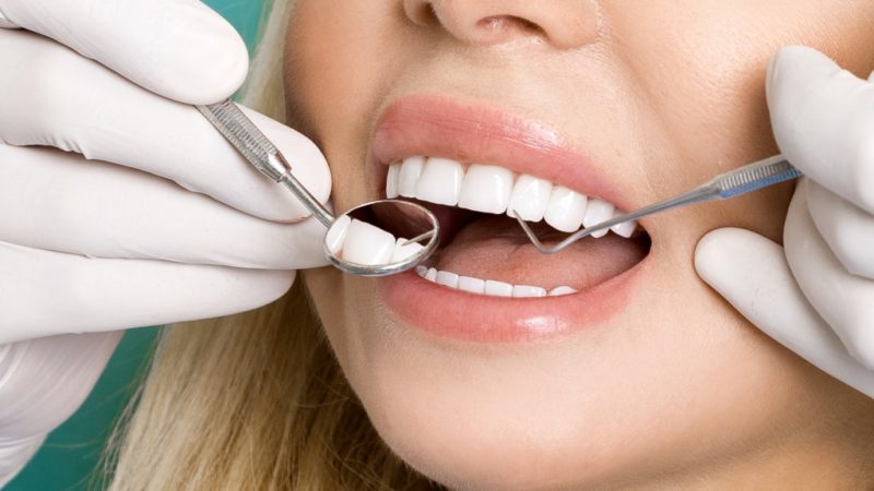 مزایا و معایب روکش های لومینیرز دندان | بهترین دندانپزشک اصفهان