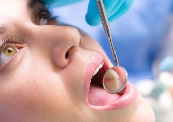 روش های درمانی اپن بایت | بهترین دندانپزشک زیبایی اصفهان