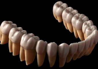 بررسی تعداد ریشه‌های انواع دندان | بهترین دندانپزشک اصفهان