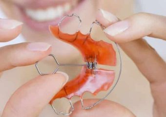 مزایا و معایب انواع مختلف ارتودنسی متحرک دندان | بهترین دندانپزشک اصفهان