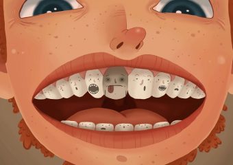 پیشگیری و درمان عوامل سیاه شدن دندان | بهترین دندانپزشک اصفهان