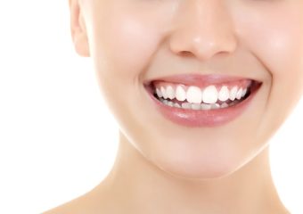 نکات مراقبتی بعد از بلیچینگ دندان | بهترین ایمپلنت اصفهان