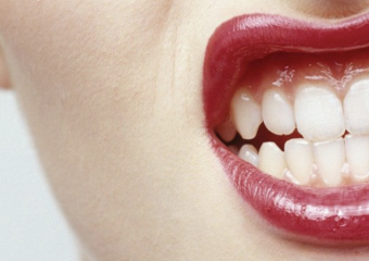 عادت های نادرست و خرابی دندان‌ها | بهترین ایمپلنت اصفهان