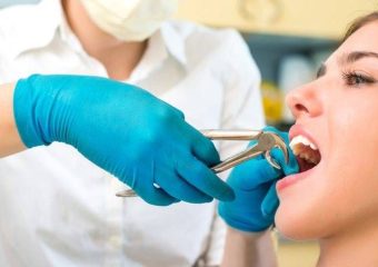 علل کشیدن دندان در ارتودنسی | بهترین دندانپزشک اصفهان