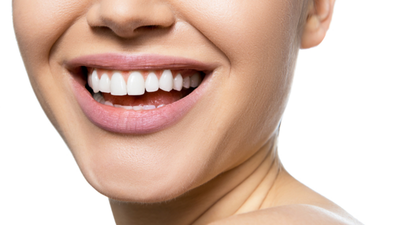 روش های مختلف سفید کردن دندان | بهترین ایمپلنت اصفهان