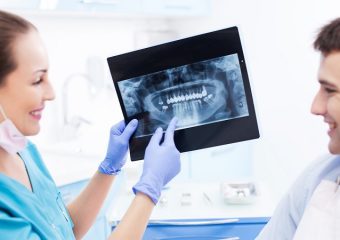 کاربرد انواع عکس او پی جی دندان | بهترین ایمپلنت اصفهان