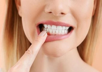 بهترین ایمپلنت اصفهان | بهترین دندانپزشک زیبایی اصفهان | بهترین دندانپزشک اصفهان | بهترین دندانپزشک کودکان اصفهان | پیشگیری و درمان التهاب لثه