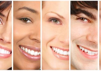 بررسی انواع روکش دندان | بهترین ایمپلنت اصفهان