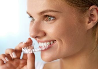 مقایسه انواع روش های ارتودنسی نامرئی | بهترین ایمپلنت اصفهان