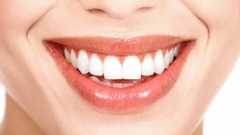 نحوه روکش کردن دندان | بهترین دندانپزشک اصفهان