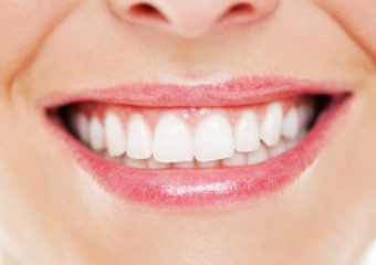 ویتامین ها و مواد معدنی مفید | بهترین دندانپزشک اصفهان