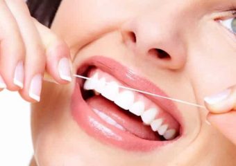 نکات مراقبتی برای لمینت دندان | بهترین دندانپزشک اصفهان