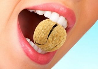 نکات مراقبتی در غذا خوردن با لمینت دندان | بهترین دندانپزشک اصفهان