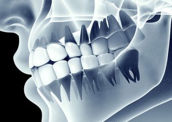 آشنایی با کاربرد دندان های انسان | بهترین دندانپزشک اصفهان