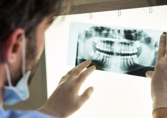 فواید عکس cbct | بهترین ایمپلنت اصفهان