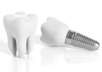 معایب ایمپلنت با پانچ | بهترین ایمپلنت اصفهان