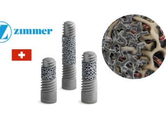 آشنایی با ایمپلنت زیمر ZIMMER | بهترین دندانپزشک زیبایی اصفهان