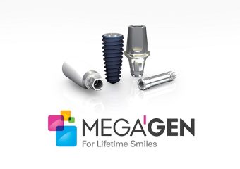 موارد کاشت ایمپلنت مگاژن | بهترین دندانپزشک زیبایی اصفهان