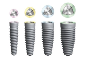 کاربردهای ایمپلنت اینترالاک | بهترین دندانپزشک زیبایی اصفهان