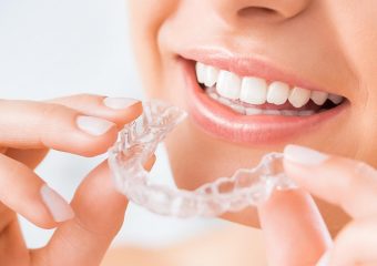 مزایا و معایب استفاده از ارتودنسی اینویزیلاین | بهترین ایمپلنت اصفهان