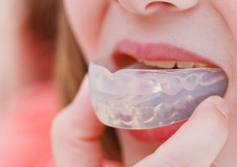 نکات مراقبتی در استفاده از محافظ دهان | بهترین دندانپزشک زیبایی اصفهان