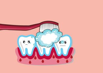 پیشگیری و درمان خونریزی لثه | بهترین ایمپلنت اصفهان