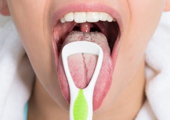 اهمیت تمیز کردن زبان | بهترین ایمپلنت اصفهان