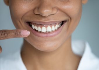 روش های تقویت دندان | بهترین دندانپزشک زیبایی اصفهان