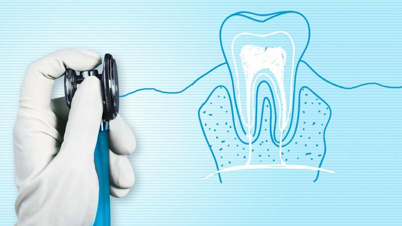 روش های درمان بی دندانی | بهترین ایمپلنت اصفهان
