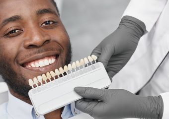 معرفی انواع روکش دندان | بهترین ایمپلنت اصفهان