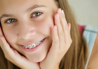 روش های ارتودنسی دندان کودکان | بهترین ایمپلنت اصفهان