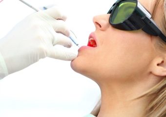 فناوری لیزر در دندانپزشکی | بهترین دندانپزشک کودکان اصفهان