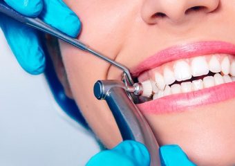 نکات مراقبتی پس از جرم گیری دندان | بهترین دندانپزشک کودکان اصفهان