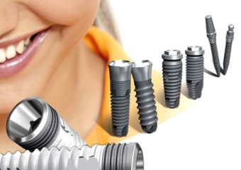 نکاتی برای کاشت ایمپلنت ساب پریو استیل | بهترین دندانپزشک اصفهان