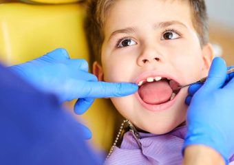 علل وجود دندان نهفته در کودکان | بهترین ایمپلنت اصفهان | دکتر ندا مکانیک