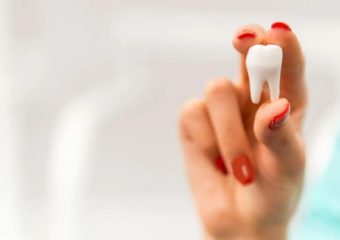 عوارض احتمالی کشیدن دندان عقل | بهترین دندانپزشک زیبایی اصفهان | دکتر ندا مکانیک