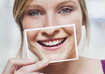 مقایسه کامپوزیت‌ دندان سارمکو با کاریزما و IPS | بهترین دندانپزشک کودکان اصفهان | دکتر ندا مکانیک