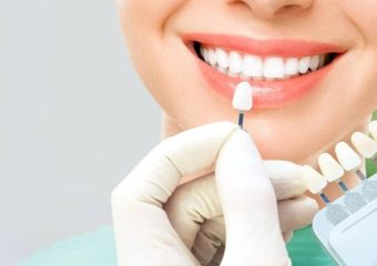 نکات مراقبتی از دندان لمینت شده | بهترین دندانپزشک زیبایی اصفهان | دکتر ندا مکانیک