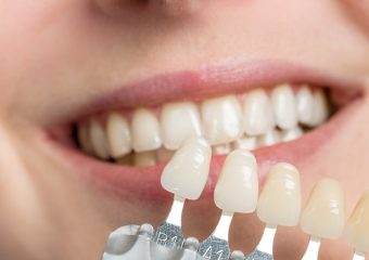 آیا می شود رنگ کامپوزیت را تغییر داد؟