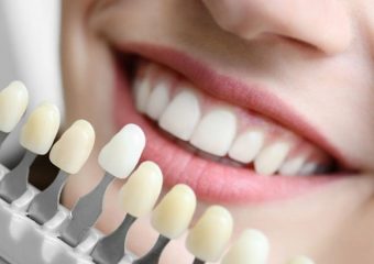 بهترین دندانپزشک اصفهان | دکتر ندا مکانیک