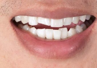 بهترین دندانپزشک اصفهان | دکتر ندا مکانیک