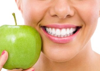 باید‌‌ها و نباید‌های غذا خوردن بعد از کامپوزیت دندان | بهترین ایمپلنت اصفهان | دکتر ندا مکانیک