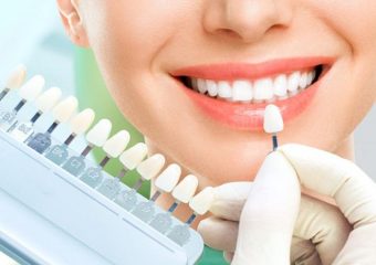 معرفی بهترین برندهای کامپوزیت دندان | بهترین دندانپزشک زیبایی اصفهان |دکتر ندا مکانیک