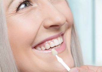 موارد کاربرد لمینت دندان| بهترین دندانپزشک اصفهان | دکتر ندا مکانیک