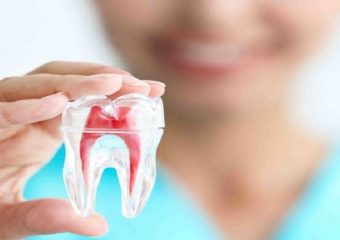 بسته بودن کانال های دندان | بهترین دندانپزشک اصفهان - بهترین ایمپلنت اصفهان - بهترین دندانپزشک زیبایی اصفهان - بهترین دندانپزشک کودکان اصفهان