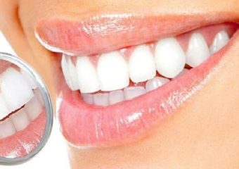 کامپوزیت روی دندان عصب کشی شده | بهترین دندانپزشک اصفهان - بهترین ایمپلنت اصفهان - بهترین دندانپزشک زیبایی اصفهان - بهترین دندانپزشک کودکان اصفهان