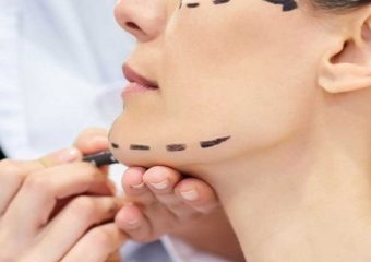 عوارض جراحی فک | بهترین دندانپزشک اصفهان - بهترین ایمپلنت اصفهان - بهترین دندانپزشک زیبایی اصفهان - بهترین دندانپزشک کودکان اصفهان